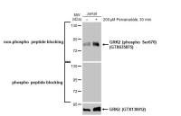 GRK2 antibody