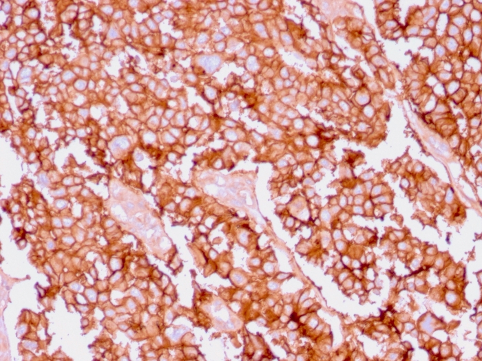 EpCAM antibody [EGP40/1556R]