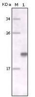 MERTK antibody [7E5G1]