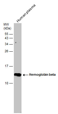 Hemoglobin beta antibody