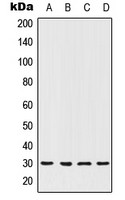 HOXC12 antibody