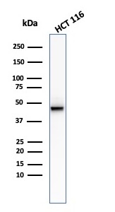 Cytokeratin 8 antibody [KRT8/2174R]