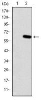 HFE antibody [3F1]