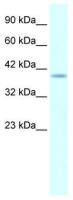 HMX1 antibody, Internal