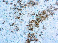 Mesothelioma antibody [HBME-1]