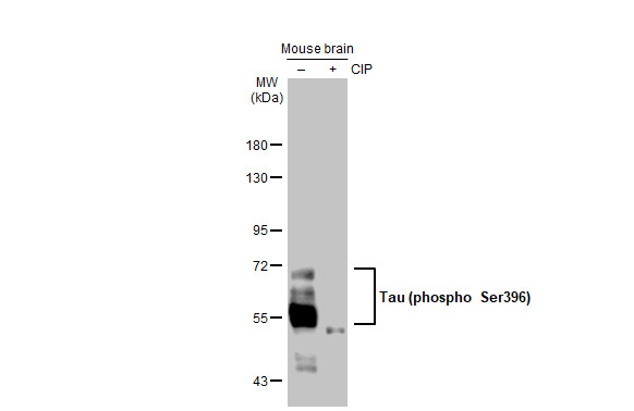 Tau (phospho Ser396) antibody [GT1292]