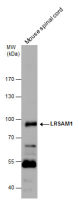 LRSAM1 antibody