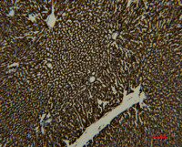 Transferrin antibody [7H11]