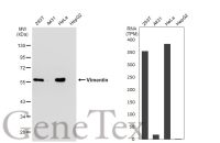 Vimentin antibody [GT1180]