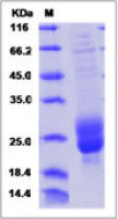 Human M-CSF protein (active)