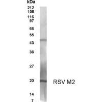 Respiratory Syncytial virus M2 antibody