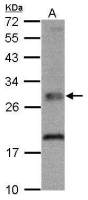 TPK1 antibody