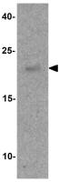 SPIB antibody