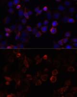 S100A4 antibody