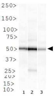 Rad51B antibody [1 H3/13]