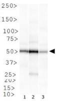 Rad51B antibody [1 H3/13]