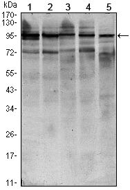 STAT6 antibody [7D3]