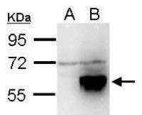 TIP60 antibody