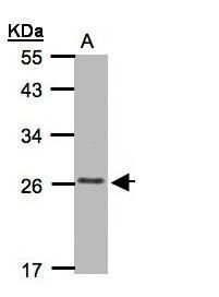 CKLFSF5 antibody [C2C3], C-term