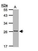 CKLFSF5 antibody [C2C3], C-term