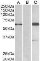 BAIAP2 (isoform 3) antibody