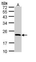 RBP4 antibody