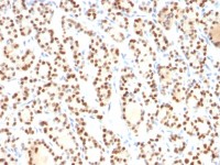 NKX2.1 antibody [8G7G3/1]