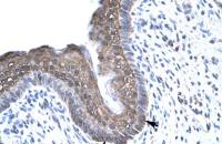 FOXE3 antibody, C-term