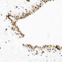 Topoisomerase I antibody