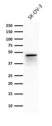Cytokeratin 8 antibody [TS1]
