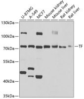 Transferrin antibody