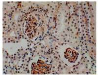 CD62E antibody [9J12]