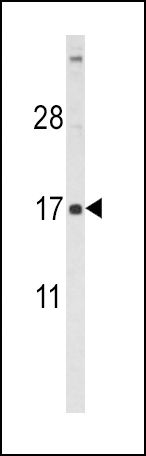 FSH beta antibody, Internal