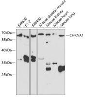 AChR alpha 1 antibody