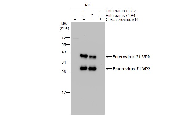 Enterovirus 71 VP2 antibody