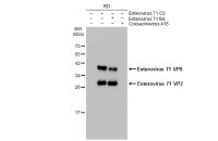 Enterovirus 71 VP2 antibody
