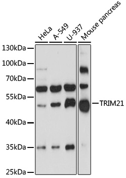 SSA1 antibody
