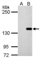 DNMT3B antibody