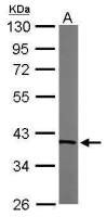 Transaldolase antibody