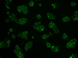 Hexokinase II antibody [4C5]