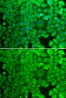 Glycogen synthase 1 antibody