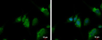 QTRT1 antibody