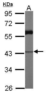 CARP antibody [N3C3]