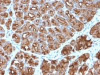 MUC1 antibody [MUC1/2818R]