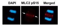 Myosin Light Chain 2 (MLC-2v) (phospho Ser15) antibody