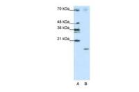 SRP19 antibody, Internal