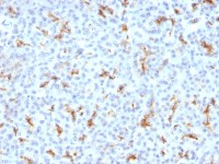 CFTR antibody [CFTR/1342]