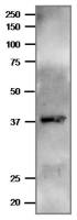 Plasmodium falciparum FNR antibody