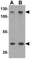 MUC1 antibody