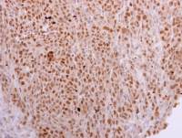 NOSIP antibody [N1C3]